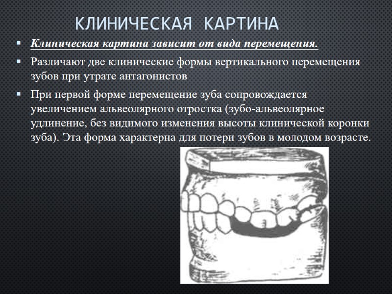 Клиническая картина   Клиническая картина зависит от вида перемещения. Различают две клинические формы